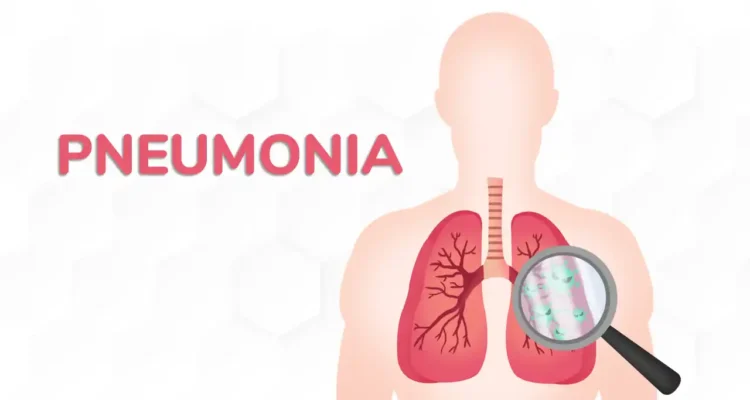 Penyakit Pneumonia